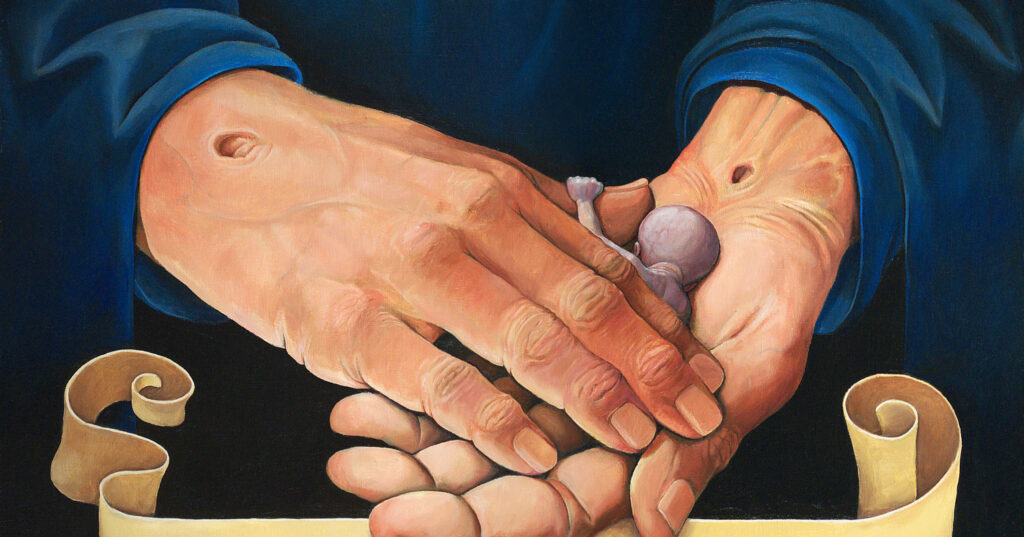 A Living Hospice: Loving my unborn son after his diagnosis